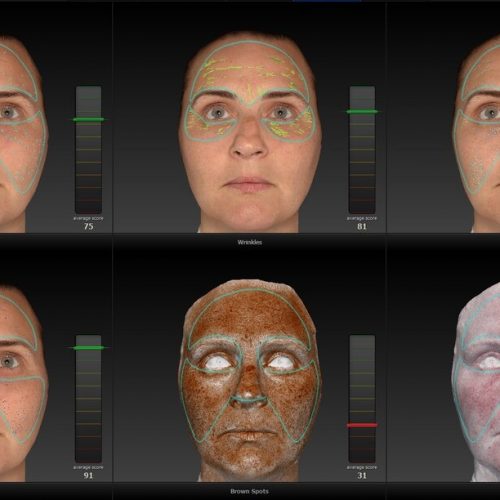 ۳D Skin Analyzer + Simulator